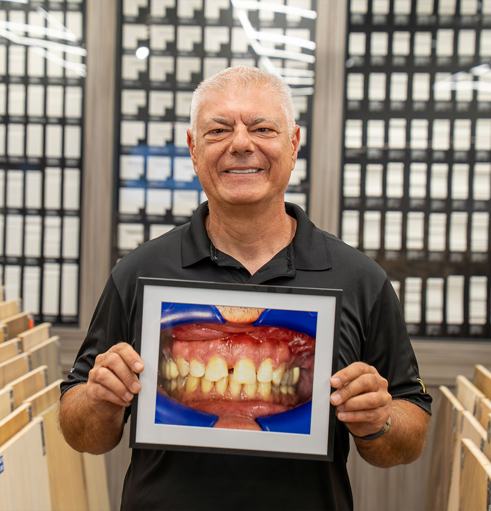 Paitent holding up before and after photo of teeth