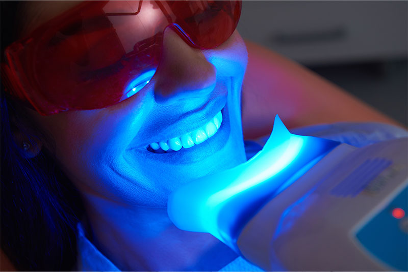 teeth whitening