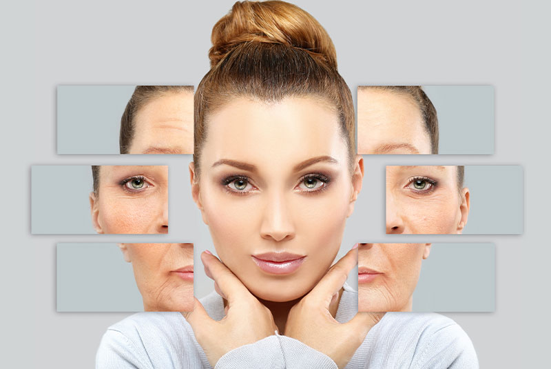 before and after of botox